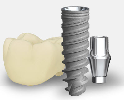 Dental Implants&nbsp;
